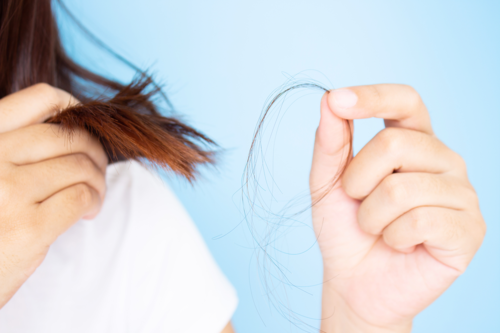 Perte de cheveux, causes, traitements et conseils