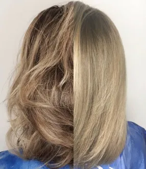 Cryothérapie cheveux